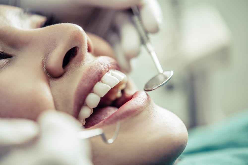 ¿Qué es el contorneado dental?