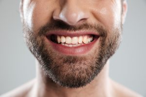 El impacto de la nutrición en la fortaleza de tu esmalte dental